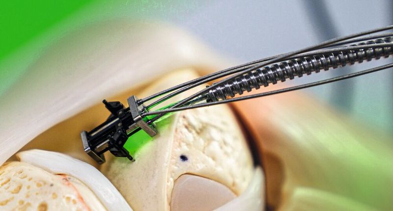 The miniature robot can be fixed directly on site in the tissue, e.g. of the knee joint. (Image: Beckhoff)