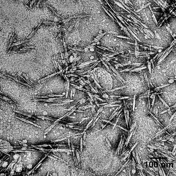 Blick durch das Mikroskop: stäbchenförmige Zellulose-Nanokristalle von rund 120 nm Länge und 6,5 nm Durchmesser. (Empa)