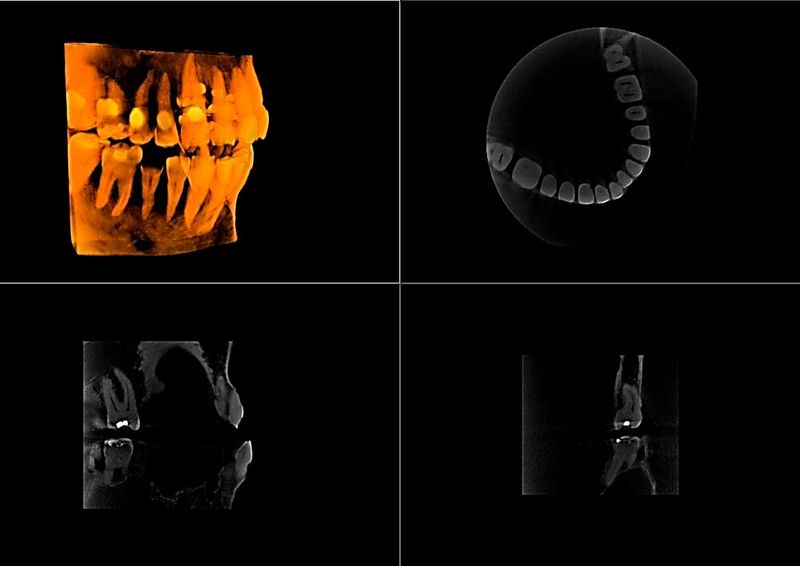 CT images in the field of oral medicine. (Bild: Haozhi Imaging Technology Co., Ltd.)