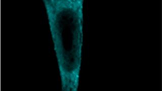 Heidelberger Wissenschaftler haben einen neuen Ansatz zur Überprüfung funktionaler Proteinkomplexe entwickelt (Ausschnitt) (Isabel M. Schopp, Biochemie-Zentrum der Universität Heidelberg)
