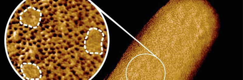 Microscopy image of a living E. coli bacterium, revealing the patchy nature of its protective outer membrane. A densely packed network of proteins is interrupted by smooth, protein-free islands (labelled by dashed lines in the inset). (Benn et al. UCL)