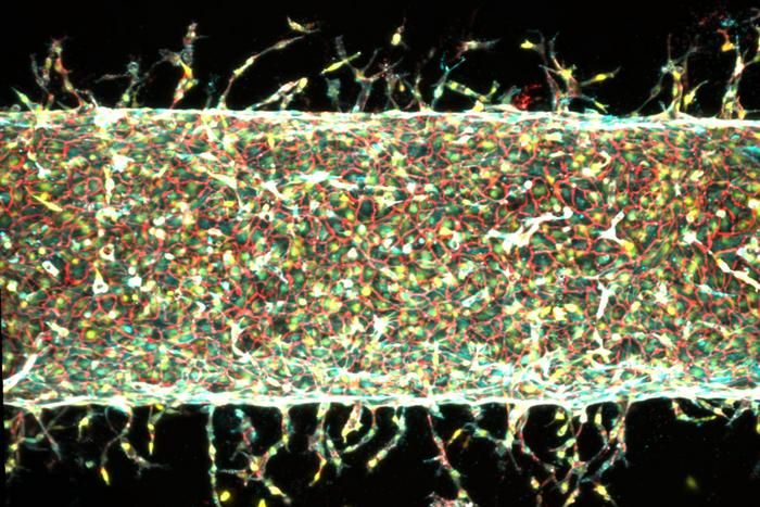Künstliche Blutgefäße durch gezieltes Dehnen Es ist ein hehres Ziel der Medizinforschung: lebende Organe und Gewebe aus Zellen züchten, um erkrankte und beschädigte Organe im Körper zu ersetzen. Bislang ist es Wissenschaftlern bereits gelungen, künstliche Muskeln, Lebern, Nieren und Haut zu entwickeln. Doch es fehlte eine zuverlässige Methode, um präzise strukturierte Blutgefäßnetzwerke zu konstruieren. Jetzt haben Ingenieure des Massachusetts Institute of Technology einen Weg gefunden, Blutgefäße durch mechanisches Dehnen zu züchten und zu steuern. Das Team baute ein „Blutgefäß auf einem Chip“ aus menschlichen Endothelzellen und bettet es in ein Gel ein, das einen kleinen Magneten enthält. Die Forscher untersuchten, wie die zentrale Arterie reagierte, während sie das Gel mit einem externen Magneten hin und her bewegten. Das wiederholte mechanische Dehnen stimulierte die Arterie dazu, kleinere Kapillaren auszubilden. Durch Änderung der Dehnrichtung und -intensität konnten die Forscher die Richtung und Menge der neuen Gefäße präzise steuern.    Hier geht‘s zur Originalmeldung Wissenschaftsbild des Tages vom 28.7.2026  (Bild: Courtesy of Ritu Raman)