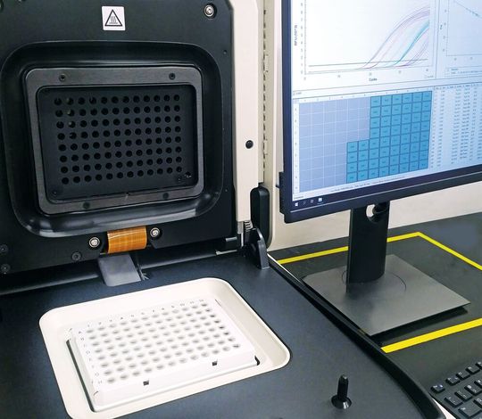 Abb.1: Unter RNase-freien Bedingungen ist die Reverse-Transkriptase-Polymerase-Kettenreaktion (RT-PCR) ein äußerst genaues Verfahren zur Erkennung von SARS-CoV-2. Abb.1: Unter RNase-freien Bedingungen ist die Reverse-Transkriptase-Polymerase-Kettenreaktion (RT-PCR) ein äußerst genaues Verfahren zur Erkennung von SARS-CoV-2.
