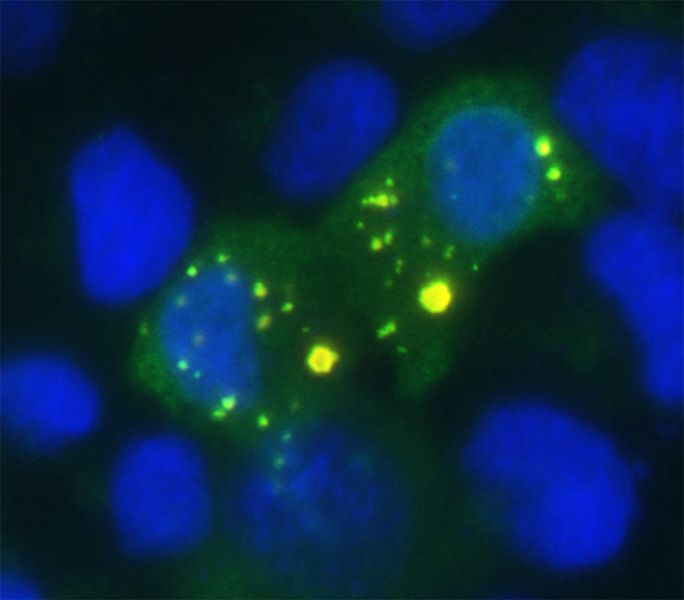 Das Anti-Virus-Protein Aim2 (grün) patrouilliert im Zytoplasma einer humanen Zelle (Hela), wo es mit dem Adaptorprotein ASC (rot) interagiert (DNA: blau).  (Bild: CeMM)