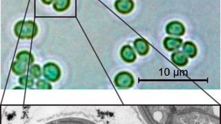 Cyanobakterien der Gattung Synechocystis sp. PCC 6803: Oben im lichtmikroskopischen Bild, unten im Transmissions-Elektronenmikroskop. (Ausschnitt) (Alexander Klotz)
