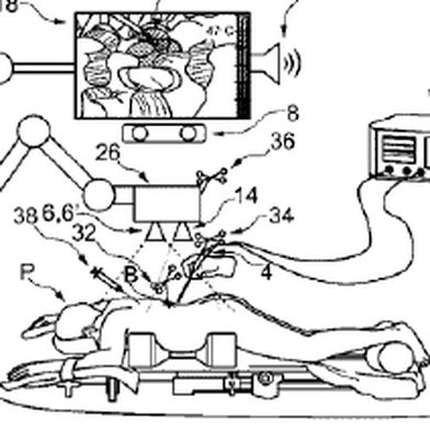 Medizinisches System mit Wärme­kamera (Bild: B. Braun New Ventures/DPMA)