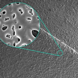 Scanning electron microscope image of a silver-doped porous micro-arc oxide layer on titanium.(Image: Fraunhofer IFAM)