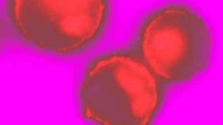 Mastzellen, die eine fluoreszierende Probe enthalten, die spezifisch das Membranlipid PtdIns(3,4,5)P3 bindet. Dieses Lipid gibt Auskunft über den Aktivierungszustand der Mastzellen. (Bild: Uni Basel)