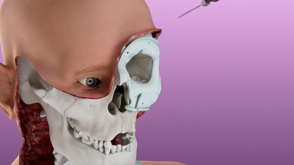 Wer macht das Rennen um den 3D Pioneers Challenge Award? 43 Finalisten hoffen auf die Auszeichnung. So auch die 3D-Technologien von Materialise, die eine entscheidende Rolle bei der weltweit ersten Ganzaugentransplantation spielen.(Bild:  3DPC)