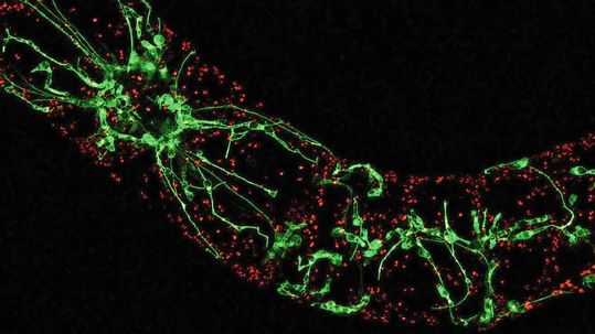 Pflanzen zeigen der Hitze den „Finger“: Geraten Pflanzen durch hohe Temperaturen oder Trockenheit in Stress, bilden sich im Innern der Zellen Ausstülpungen, die Schutzprogramme auslösen. (Bild:  Toranj Rahpeyma, KIT)