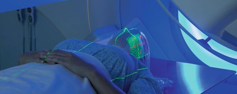 Strahlentherapien können stark beeinträchtigende fibrotische Hautschädigungen verursachen. Ein Schlüsselfaktor bei der Entstehung dieser Strahlenschäden ist das Protein Dickkopf-3, wie Forscher des DKFZ nun gezeigt haben. (Symbolbild)(Bild: ©  Mark Kostich - stock.adobe.com)