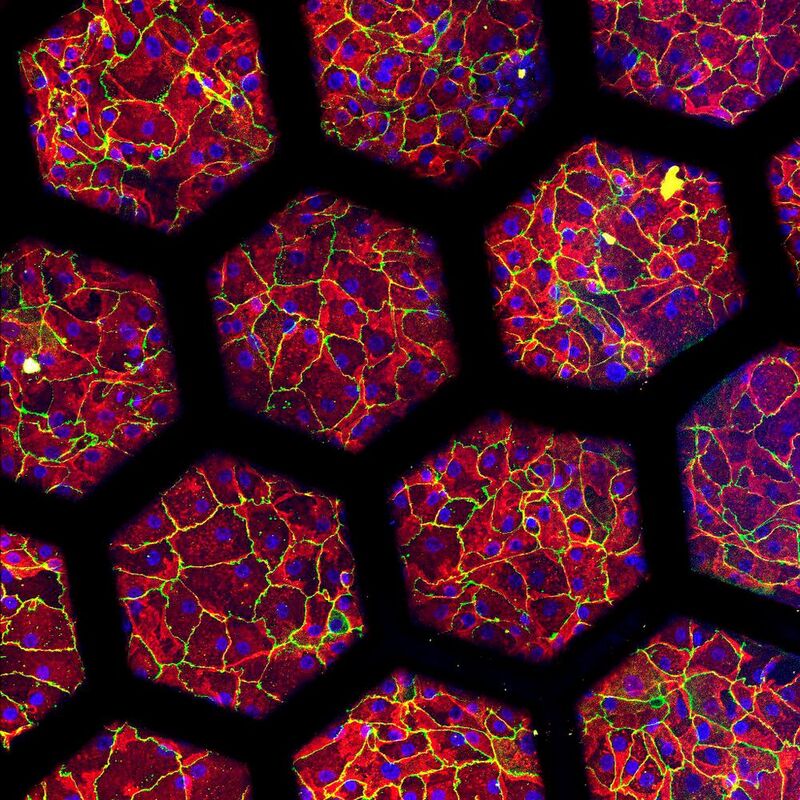 Eingefärbte Patientenzellen, die auf einer „Lunge auf Chip“ der zweiten Generation kultiviert wurden. 