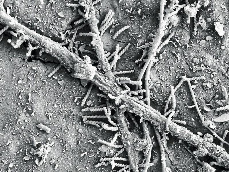 Bakterien gesellen sich für den Bioabbau zu den Pilzfäden. (ETH Zürich / Gruppe Umweltchemie)
