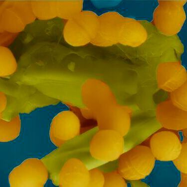 mage from an electron microscope showing how Enterococcus faecalis bacteria clump together to share, among other things, antibiotic resistance with each other.(Source:  Josy ter Beek)