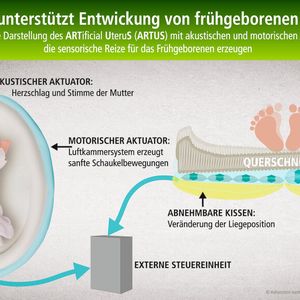Wie im fötalen Stadium: Statt der Gebärmutter unterstützt ein textiler Uterus die senso-motorische Entwicklung unter anderem durch entsprechenden Herzschall der Mutter.