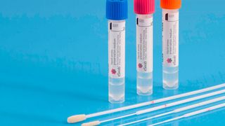 Im Rahmen einer gemeinsamen Initiative will Toolsgroup von der Copan-Gruppe Abstriche erwerben und diese an besonders von der Corona-Pandemie betroffene Regionen spenden. (Bild: Copan Gruppe)