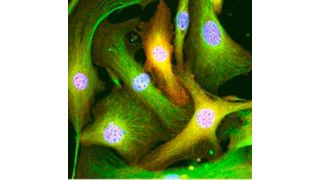 Göttinger Forscher entwickelten eine neue Methode, mit der die im Bindegewebe der Niere verborgenen Fibroblasten (grün) gezielt von krankheitsverursachenden epigenetischen Veränderungen (orange) gesäubert werden können. (umg)