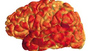 Die Dicke der menschlichen Hirnrinde korreliert mit dem epigenetischen Profil immunrelevanter Gene. (Universität Basel, Transfakultäre Forschungsplattform Molecular and Cognitive Neurosciences)