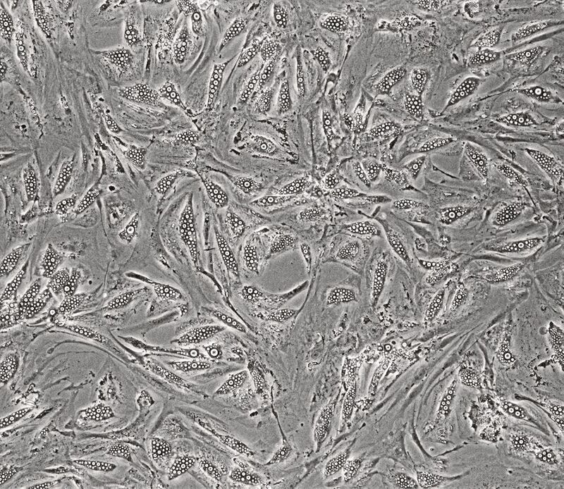 Mikroskopische Aufnahme von humanen Adipozyten, in denen sich Lipidtropfen (weiß) ansammeln.