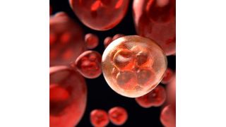 Myeloma is the second most common blood cancer, and t(4;14) myeloma comprises 15 to 20 per cent of MM cases.  (Source: Pixabay)