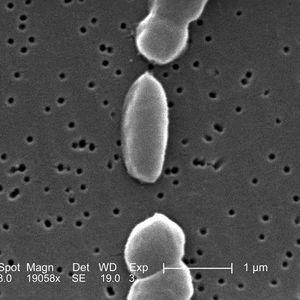 Abb. 2: Der humanpathogene Erreger Vibrio parahaemolyticus kann beim Menschen Gastroenteritis auslösen und für Risikopatienten tödlich sein. 