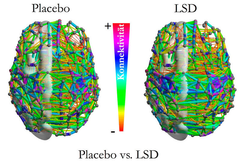 Unter Einfluss von LSD (rechts) nimmt die Vernetzung von Regionen höherer Hirnfunktion (Konnektivität) zu. (Foto/Copyright: Enzo Tagliazucchi)