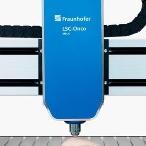 The laser scanning microscope of the LSC-Onco project is so small and compact thanks to the use of MEMS technology that it can also be used directly on the patient in the operating room.(Source:  Fraunhofer IPMS)