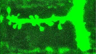 Beim Lernen wachsen auf Nervenzellen neue Fortsätze ... (Bild: MPI für Neurobiologie / Meyer)