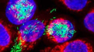 Mit einer an der Universität Würzburg entwickelten neuen Methode können Forscher weit detaillierter als bisher nachvollziehen, was bei Infektionen in Krankheitserregern und den von ihnen befallenen Zellen vor sich geht. Das Foto zeigt menschliche Zellen (rot/blau), die mit Salmonellen (grün) infiziert wurden. Die Bakterien wurden mit einem fluoreszierenden Farbstoff markiert; das erklärt ihre grüne Farbe. (Bild: IMIB)