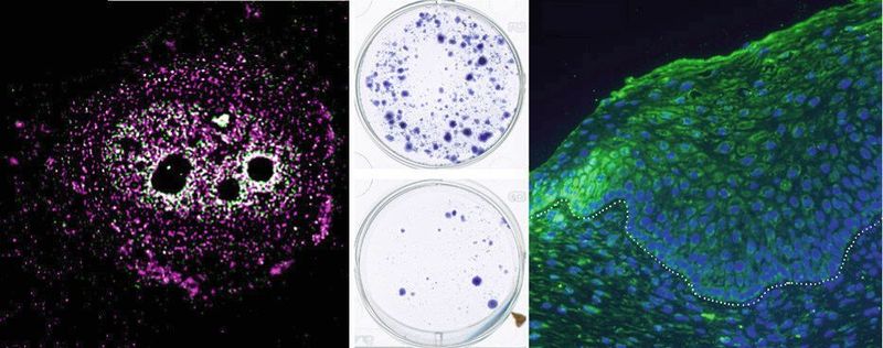 (v.l.n.r.): MYPOP-Lokalisation (magenta) in einer Hautzelle; Wachstum von HPV-Krebszellen ohne (oben) und mit MYPOP (unten); Gewebeschnitt eines HPV-Tumors (grün = MYPOP, blau = Zellkerne) (Universitätsmedizin Mainz)