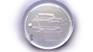 Abb.1: Kultur des Corynebacterium-glutamicum-Bakteriums.  (Bild: FZ Jülich)