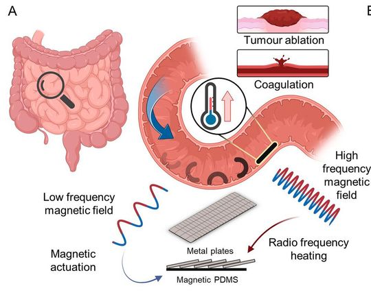 Schuppentier-inspirierter frei beweglicher magnetischer Roboter, der im Dünndarm arbeitet. Der Roboter wird mit einem niederfrequenten Magnetfeld betätigt und mit einem hochfrequenten Magnetfeld aufgeheizt.(Bild:  MPI-IS)