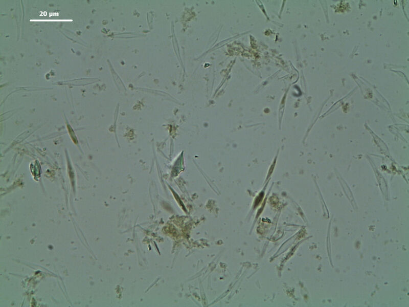 Abb.1b: Zellen der Mikroalge Phaeodactylum tricornutum nach einer Minute Aufschluss mit der Schwingmühle MM 400 (Bild: Retsch)