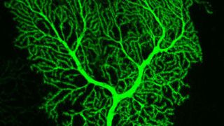 Eine gesunde Purkinje-Zelle mit weitverästelten Zellfortsätzen (Bild: Institut für Zellbiologie, Universität Bern)