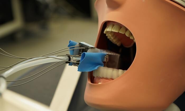 A miniature robot developed at the University of Basel could help prepare teeth for a crown. (Source: University of Basel, Catherine Weyer)