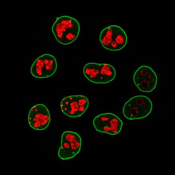 Mit Fluoreszenzfarbstoffen gekoppelte Sekundär-Nanobodies können entsprechende Sekundär-Antikörper in der Mikroskopie ersetzen. Gezeigt sind Krebszellen, bei denen Lamin A/C in grün und der Zellvermehrungsmarker Ki-67 in rot gefärbt wurden. (MPI für biophysikalische Chemie/ T. Pleiner)