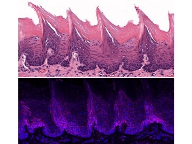 Zungenkrebs untersucht  Forscher der New York University haben ein Protein identifiziert, das eine wesentliche Rolle bei der Entstehung von Krebs auf der Zunge spielt. Die Forscher entdeckten, dass dieses Protein als Kalziumionen-Kanal das Wachstum von Mundkrebstumoren antreibt und Moleküle produziert, die eine erhöhte Schmerzempfindlichkeit verursachen. Das Bild zeigt Gewebe einer Mäusezunge unter dem Mikroskop (oben) und Lokalisierung des so genannten ORAI1-Proteins im Gewebe auf der Oberfläche der Mäusezunge (unten).    Hier gehts zur Originalmeldung Wissenschaftsbild des Tages vom 14.9.2023 (Lacruz Lab/NYU)