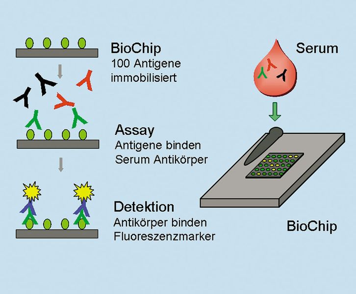 Abb.1: Prinzipieller Ablauf eines Fluoreszenz-Assays und Schema der Kartusche mit Chip. (Archiv: Vogel Business Media)