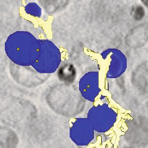 Lipidtröpfchen (blau) mit Nanopartikeln (orange)