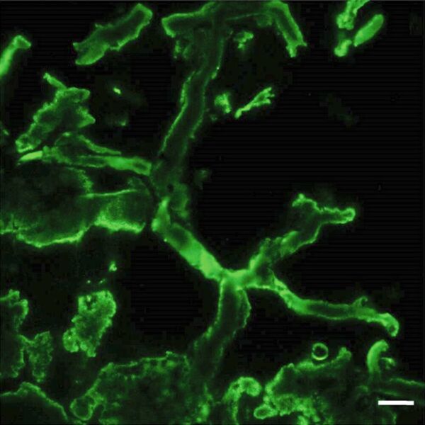 Fluoreszenzmarkierung des Chitins in einem versteinerten Myzel; Aufnahme mittels konfokaler Laser-Scanning-Mikroskopie, Maßstab 10 µm. (fungi microfossils / Bonneville et al.; DOI: 10.1126/sciadv.aax7599 / CC BY 4.0)