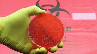 15 Pathogene stehen auf der Beobachtungsliste der WHO für Erreger mit dringendem Forschungsbedarf. (Bild: TopMicrobialStock - stock.adobe.com)
