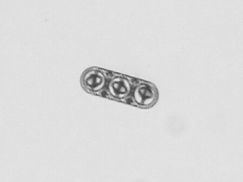 Mikroskopiebild des oben gezeigten Zwei-​Komponenten-Mikrovehikels.  (Bild: Alcântara et al. / Nature Communications 2020)