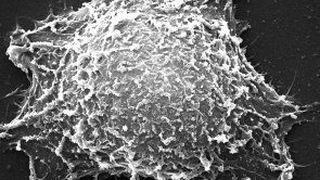 Entsprechend vorbehandelte Goldnanostäbchen können eine effektive photothermische Tumorbehandlung ermöglichen. (Quelle: Wiley-VCH) (Archiv: Vogel Business Media)