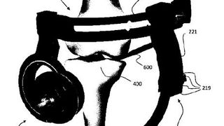 Positioniervorrichtung für die Versorgung einer Knochenfraktur mittels Knochenschrauben (Bild: OT Medizintechnik GmbH/DPMA)