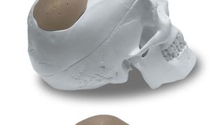 Mit dem 3D-Drucker R1 können individualisierter Medizinprodukte aus Hochleistungskunststoffen wie PEEK additiv gefertigt werden. (Kumovis)