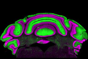 Hirnaktivität bei Bewegungsstörungen

Eine Studie der Virginia-Tech-Neurowissenschaftlerin Meike van der Heijden vom Fralin Biomedical Research Institute stellt eine weit verbreitete Annahme in der Erforschung neurologischer Bewegungsstörungen infrage. Oft konzentrieren sich Neurowissenschaftler auf die Aktivität zweier Zelltypen: Purkinje-Zellen im Kleinhirn und Zellen in den tiefen Kleinhirnkernen. Bisher gingen Forschende davon aus, dass die Aktivität der Purkinje-Zellen zuverlässig Rückschlüsse auf die Aktivität der tiefer liegenden Kernzellen erlaubt – da Purkinje-Zellen deren Aktivität hemmen.

Van der Heijdens Studie widerlegt diese Annahme. „Wir sehen, dass es keine klare lineare Beziehung zwischen der Aktivität der Purkinje-Zellen und der der tiefen Kernzellen gibt. Die Vorhersagekraft der einen für die andere ist daher sehr begrenzt“, sagt die Neurowissenschaftlerin.

Das Bild zeigt: Purkinje-Zellen im Kleinhirn (grün) und Zellen der tiefen Kleinhirnkerne (dunkle Bereiche mit grünen Einsprengseln in der Bildmitte). 

Hier geht‘s zur Originalmeldung
Wissenschaftsbild des Tages vom 2.7.2026
 (Bild: Meike van der Heijden/Virginia Tech)