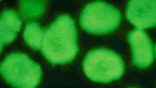 Ein Aspergillus nidulans-Reporterstamm, der grün fluoreszierendes Protein (GFP) produziert. (Bild: Maira Rosin/Leibniz-HKI)