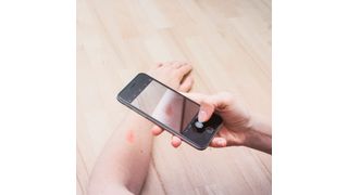 Das Start-up Onlinedoctor gilt als führender Anbieter der Teledermatologie in Europa. Fotos eines Hautproblems können samt einer kurzen Beschreibung hochgeladen werden und innerhalb von 48 Stunden gibt ein Dermatologe eine Handlungsempfehlung. (Onlinedoctor)