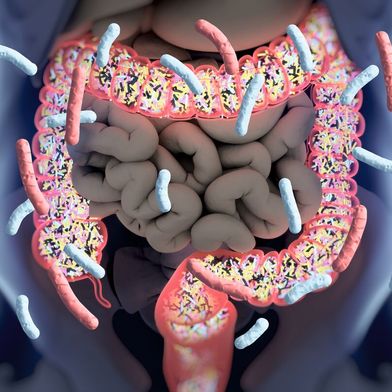 Beim extrem seltenen Eigenbrauer-Syndrom (engl. Auto-Brewery-Syndrom, ABS) vergärt die Darmflora kohlenhydratreiches Essen zu Alkohol. (Symbolbild) (Bild: © Anatomy Insider - stock.adobe.com)