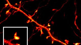 Diese STED-Aufnahme einer Nervenzelle aus der oberen Hirnschicht einer lebenden Maus zeigt die sehr feinen Verästelungen von Nervenzellen, an denen Synapsen sitzen. Im kleinen Bild sieht man das pilzförmige Ende einer solchen Verästelung, an dem die Nervenzelle Informationen von anderen Nervenzellen empfängt.  (Bild: Max-Planck-Institut für biophysikalische Chemie)